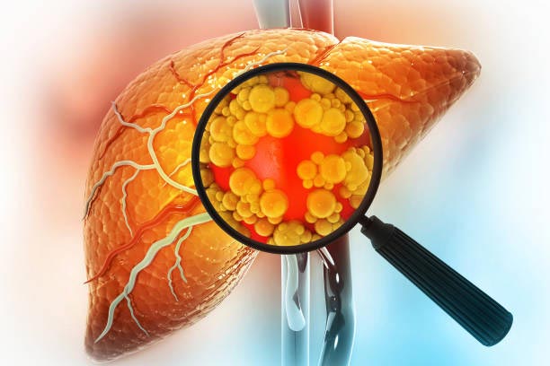 Liver disease treatment in Secunderabad